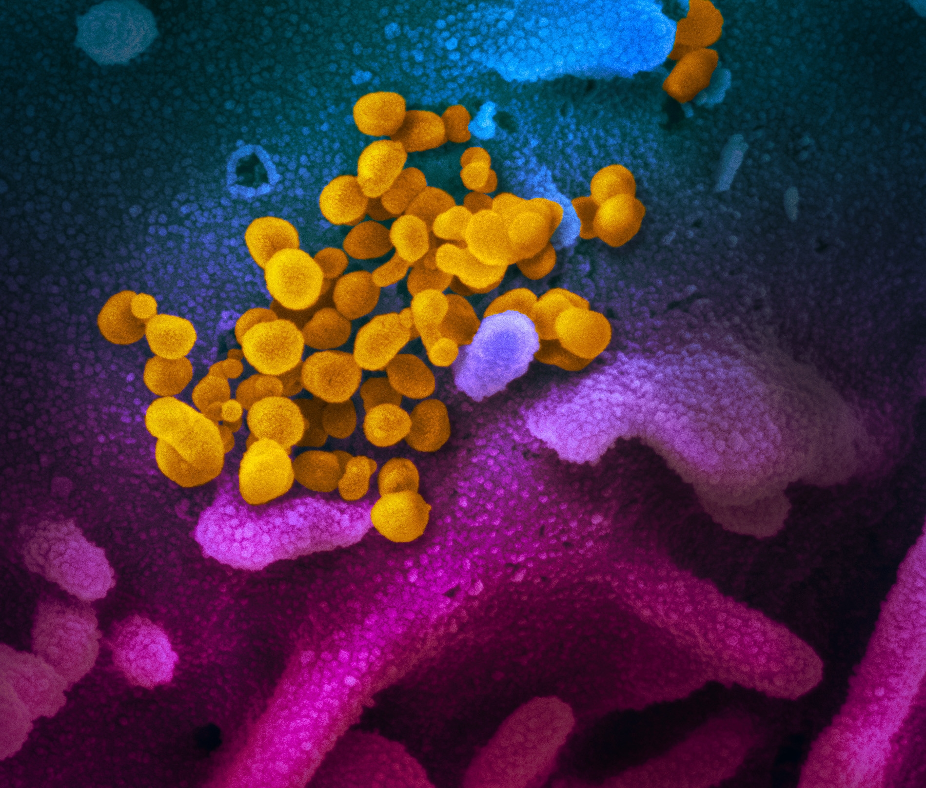 coronavirus image 1