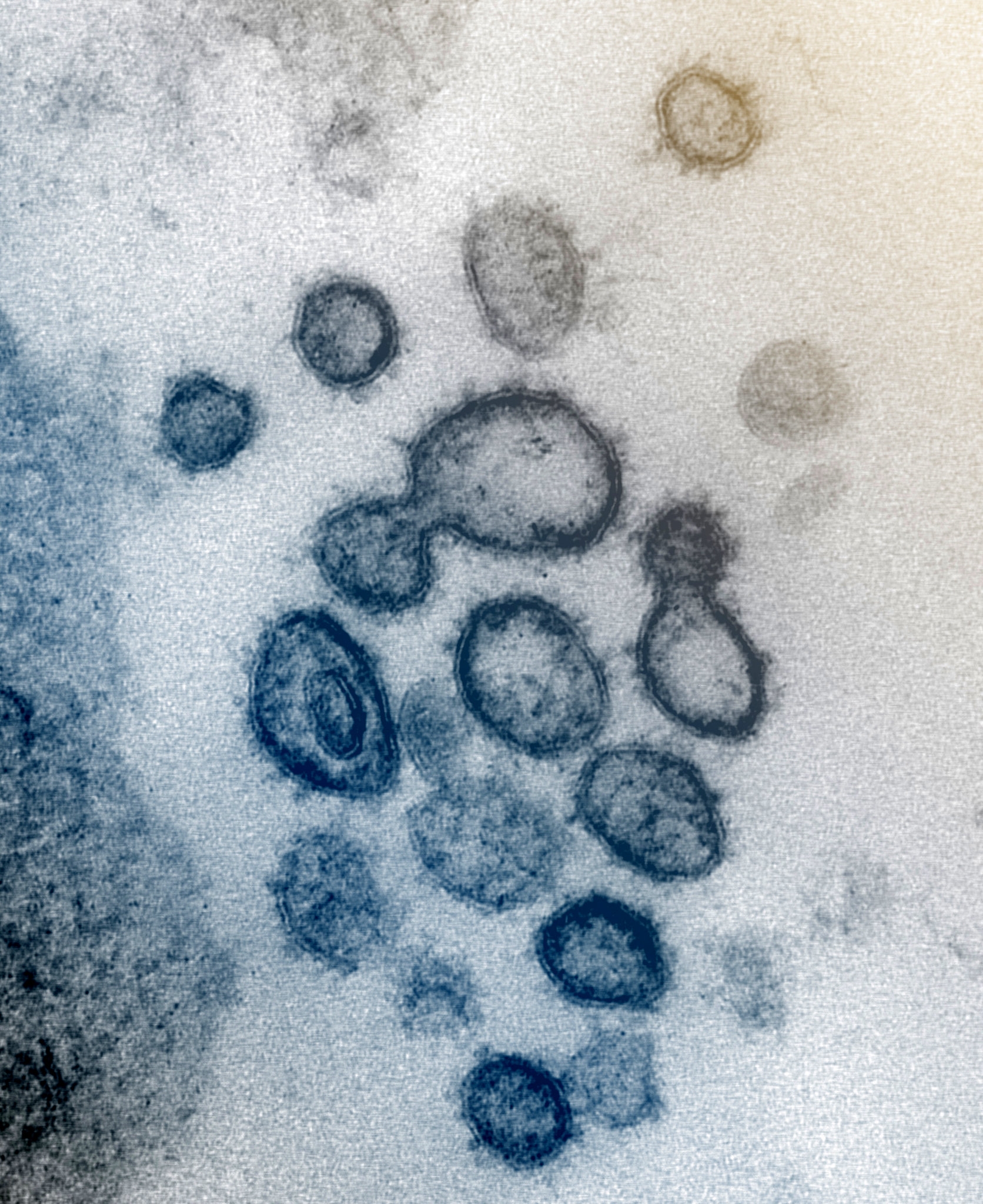 coronavirus image 