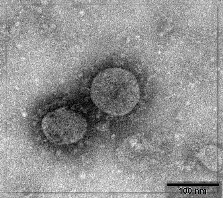pic of Coronavirus