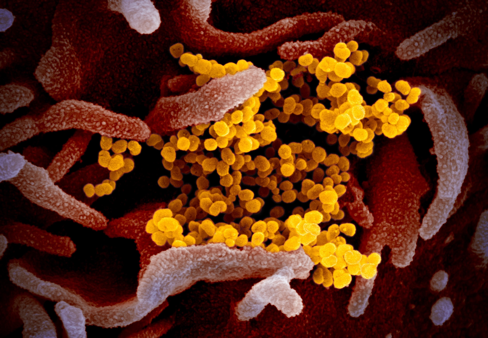 coronavirus image 4