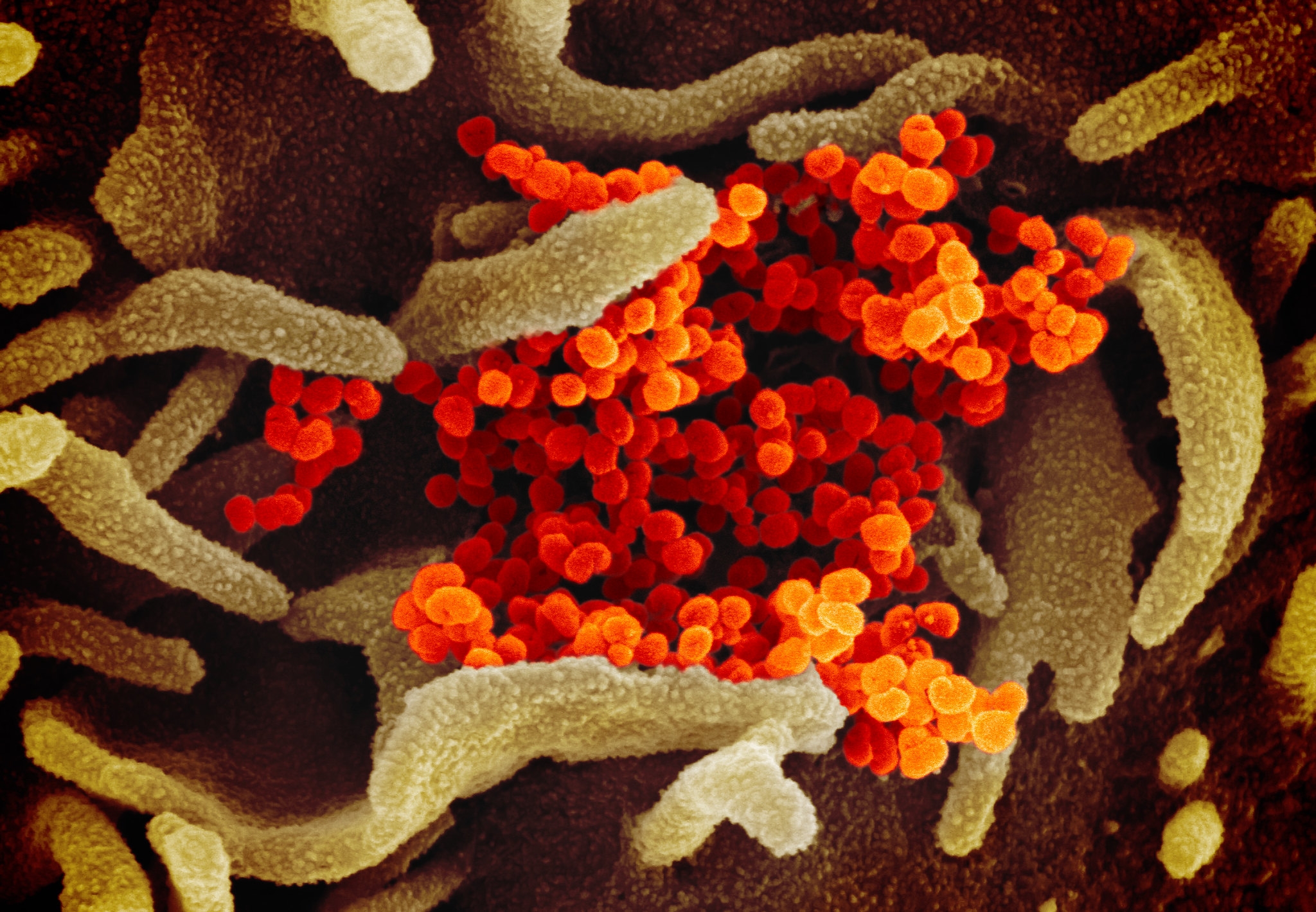 coronavirus image 5