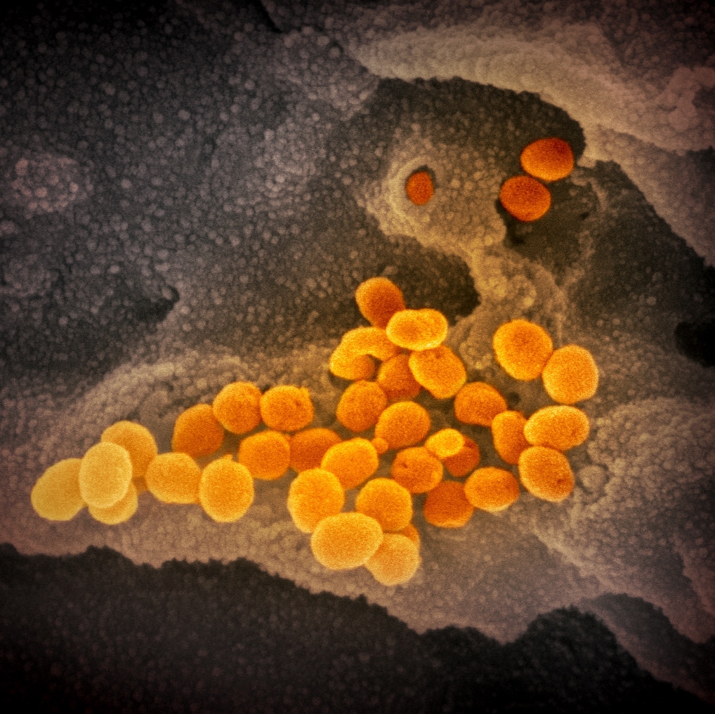 coronavirus image 6