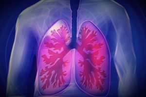 Wuhan University Experts Find Increasing Causes of New coronavirus Pneumonia Death