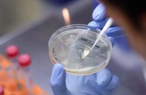 Chinese experts refer to new coronavirus pneumonia or poison attack semen